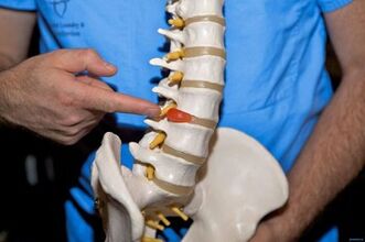 Zakaj hrbet boli v spodnjem delu hrbta in kaj storiti