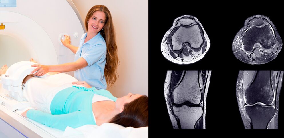 diagnoza kolenskega sklepa