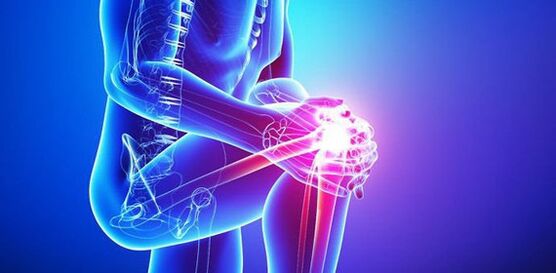 huda bolečina v kolenskem sklepu