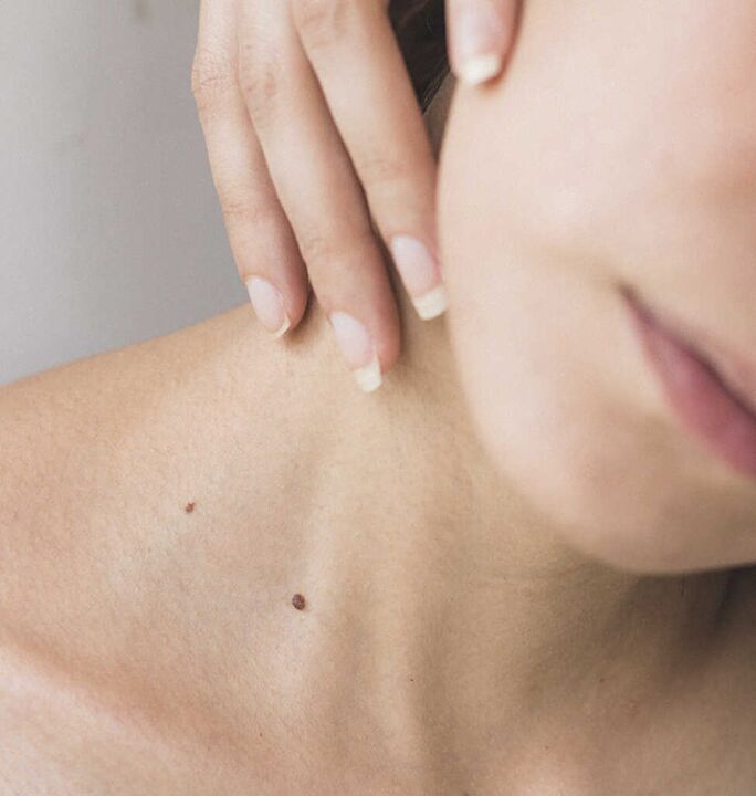 Togost vratu je eden od simptomov začetne stopnje osteohondroze vratne hrbtenice.