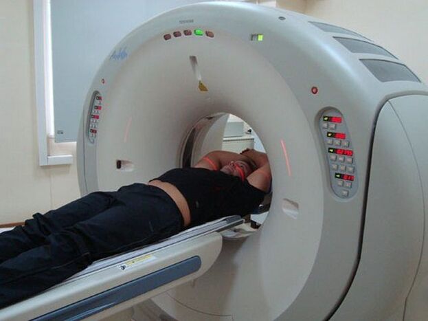diagnoza osteohondroze