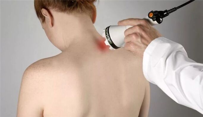fizioterapija za zdravljenje cervikalne osteohondroze