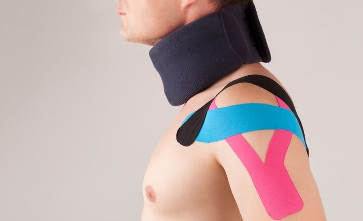 V akutnem obdobju cervikalne osteohondroze je treba nositi poseben ovratnik