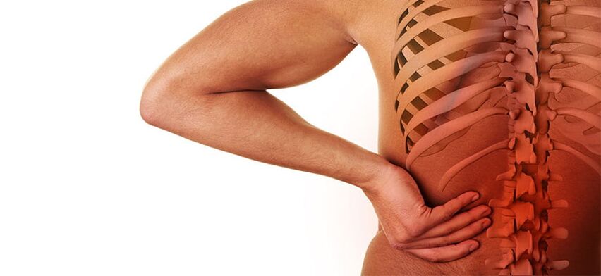 simptomi ledvene osteohondroze